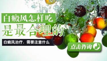 得了白癜风饮食上要注意些什么